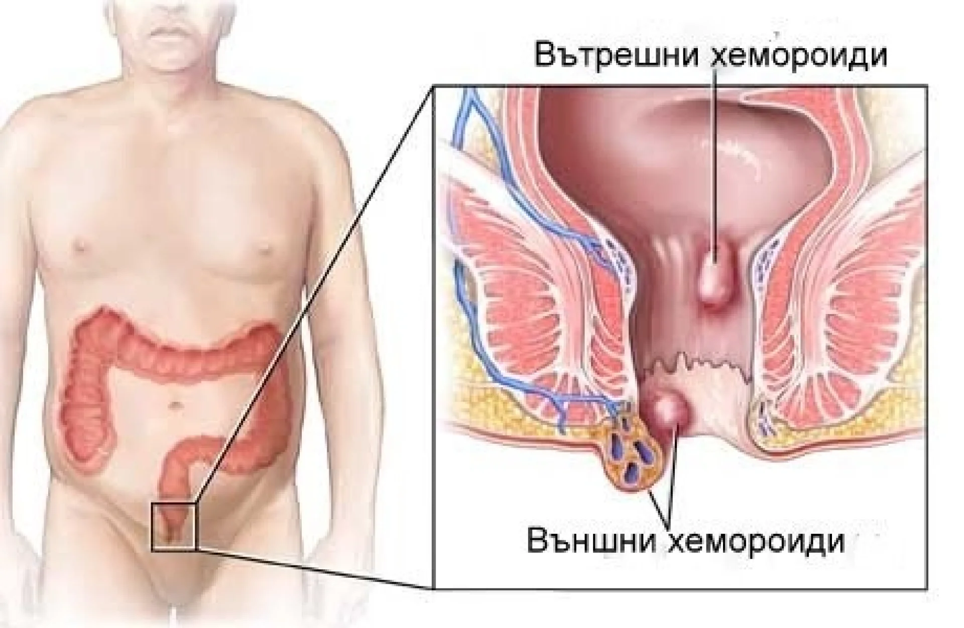 %D0%90%D0%9F%D0%A2%D0%95%D0%9A%D0%90%D0%A0%D0%A1%D0%9A%D0%98%20%D0%9C%D0%95%D0%A5%D0%9B%D0%95%D0%9C%20%D0%9F%D0%A0%D0%98%20%D0%A5%D0%95%D0%9C%D0%9E%D0%A0%D0%9E%D0%98%D0%94%D0%98